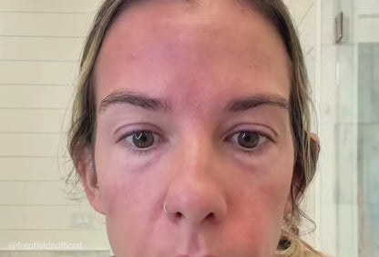 THEGLOW™ GLOWUP FACE DEVICE