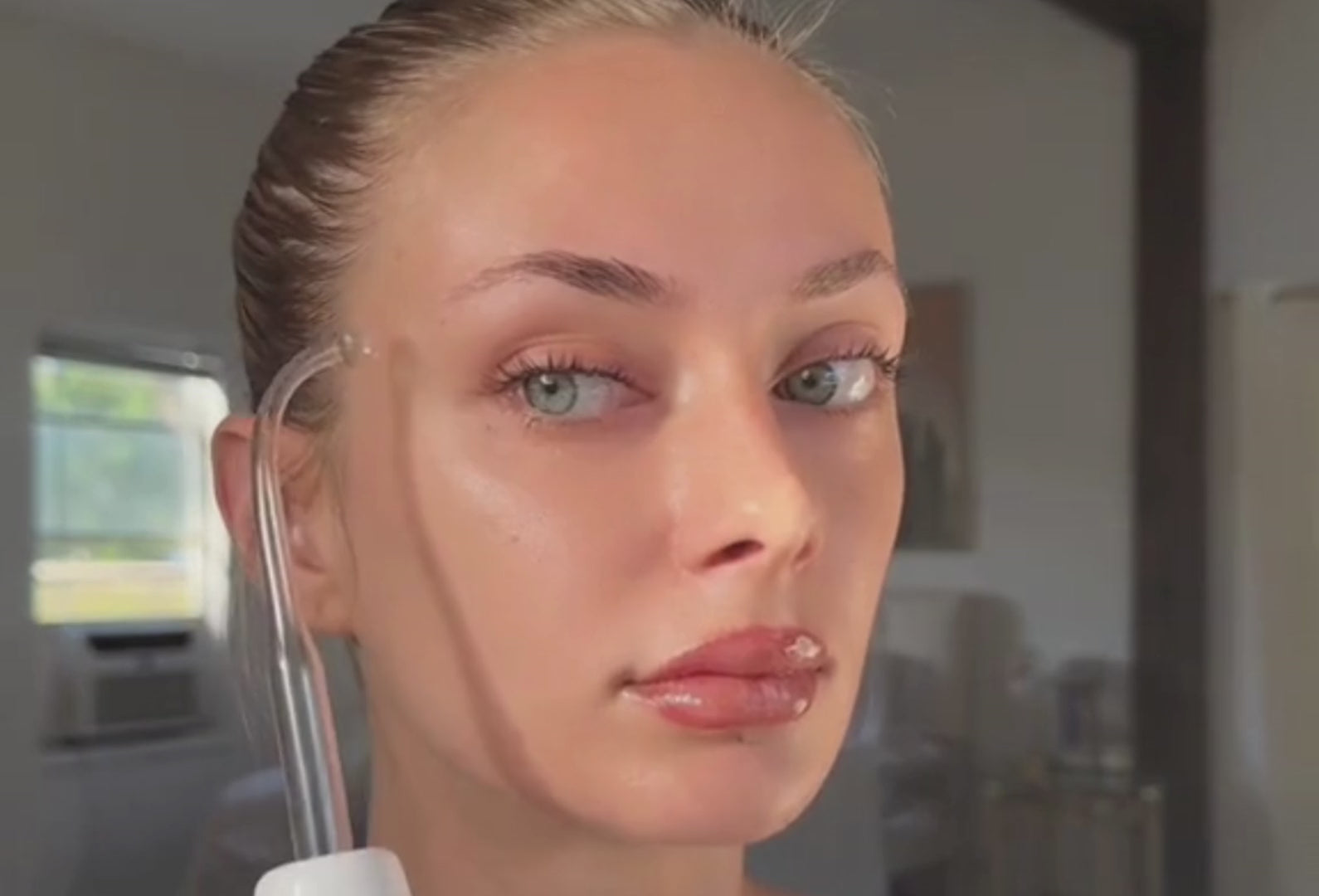 THEGLOW™ HIGH-FREQUENCY WAND SET